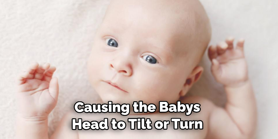  Causing the Baby's Head to Tilt or Turn